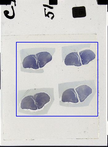 Media type: image; Special Collections 3298   shows specimen_part histological serial section;